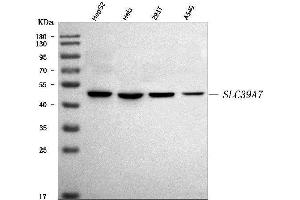 Western blot analysis of ZIP7/SLC39A7 using anti-ZIP7/SLC39A7 antibody (ABIN7600143).