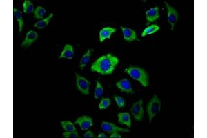 Immunofluorescence staining of A549 cells with ABIN7158397 at 1:66, counter-stained with DAPI. (EVC2 抗体  (AA 30-199))