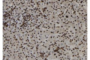 ABIN6273187 at 1/100 staining Human liver tissue by IHC-P. (ZC3HAV1 抗体  (Internal Region))