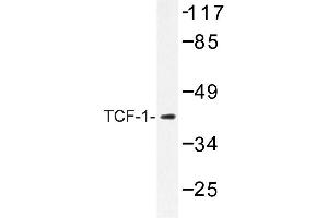 Image no. 1 for anti-HNF1 Homeobox A (HNF1A) antibody (ABIN272184) (HNF1A 抗体)