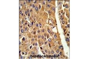Immunohistochemistry (Paraffin-embedded Sections) (IHC (p)) image for anti-Cytochrome P450, Family 3, Subfamily A, Polypeptide 5 (CYP3A5) (AA 186-218) antibody (ABIN652394)