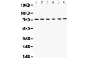 Western Blotting (WB) image for anti-LIM Domain Kinase 2 (LIMK2) (AA 596-635), (C-Term) antibody (ABIN3043412) (LIMK2 抗体  (C-Term))