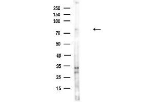 Western blot analysis of lysates from HUVEC cells(UV,30 min treatment), using IF Antibody at 1/1000 dilution.