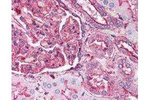 Immunohistochemistry (IHC) image for anti-Actin, beta (ACTB) antibody (ABIN2666097) (beta Actin 抗体)