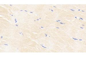 Immunohistochemistry (IHC) image for anti-Bone Morphogenetic Protein 3 (BMP3) (AA 313-471) antibody (ABIN7428818)