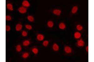 ABIN6268876 staining K562 by IF/ICC. (PIAS4 抗体  (C-Term))