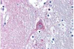 Human Brain, Caduate (formalin-fixed, paraffin-embedded) stained with MARK1 antibody ABIN239802 at 5 ug/ml followed by biotinylated goat anti-rabbit IgG secondary antibody ABIN481713, alkaline phosphatase-streptavidin and chromogen. (MARK1 抗体  (N-Term))