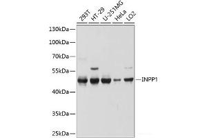 Western blot analysis of extracts of various cell lines using INPP1 Polyclonal Antibody at dilution of 1:1000. (INPP1 抗体)