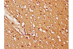 IHC image of ABIN7173447 diluted at 1:200 and staining in paraffin-embedded human brain tissue performed on a Leica BondTM system. (TRIM45 抗体  (AA 428-573))