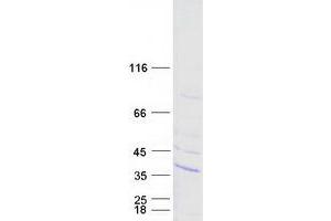 Western Blotting (WB) image for Spastic Paraplegia 21 (SPG21) (Transcript Variant 1) protein (Myc-DYKDDDDK Tag) (ABIN2725535)