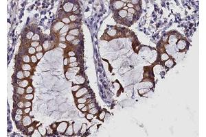 ABIN6269120 at 1/100 staining human colon tissue sections by IHC-P. (c-MET 抗体  (Internal Region))