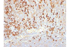 Formalin-fixed, paraffin-embedded human Tonsil stained with Plasma Cell Marker Monoclonal Antibody (LIV3G11). (Plasma Cell Marker 抗体)