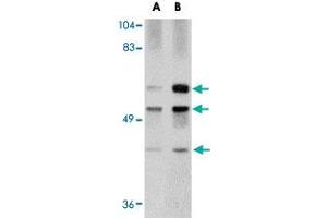 Western blot analysis of GALNT10 in rat brain tissue lysate with GALNT10 polyclonal antibody  at (A) 1 and (B) 2 ug/mL . (GALNT10 抗体  (N-Term))