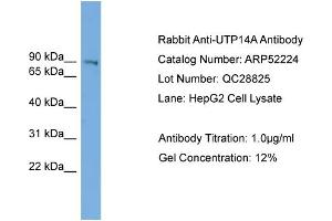 WB Suggested Anti-UTP14A  Antibody Titration: 0. (UTP14A 抗体  (N-Term))