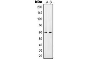 Western blot analysis of PAHT expression in HeLa (A), mouse brain (B) whole cell lysates.
