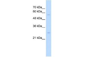 SOCS1 antibody used at 1. (SOCS1 抗体  (N-Term))