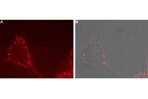 Immunocytochemistry (ICC) image for anti-Transient Receptor Potential Cation Channel, Subfamily V, Member 4 (TRPV4) (AA 647-662), (Extracellular) antibody (ABIN7043852)