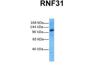 Host:  Rabbit  Target Name:  RNF31  Sample Tissue:  Human MCF7  Antibody Dilution:  1. (RNF31 抗体  (Middle Region))