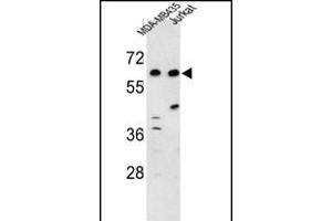 Western blot analysis of C19orf26 Antibody (Center) (ABIN653222 and ABIN2842757) in MDA-M, Jurkat cell line lysates (35 μg/lane). (C19orf26 抗体  (AA 423-450))