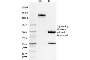 SDS-PAGE (SDS) image for anti-Ferritin, Heavy Polypeptide 1 (FTH1) (AA 58-180) antibody (ABIN6939447)