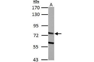 WB Image HADHA antibody detects HADHA protein by Western blot analysis. (HADHA 抗体  (C-Term))