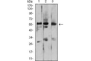 Western Blotting (WB) image for anti-Prosaposin (PSAP) (AA 17-216) antibody (ABIN7193617)