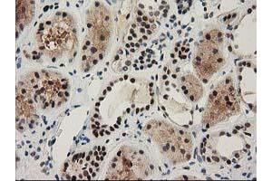 Immunohistochemical staining of paraffin-embedded Human Kidney tissue using anti-NHEJ1 mouse monoclonal antibody. (NHEJ1 抗体)