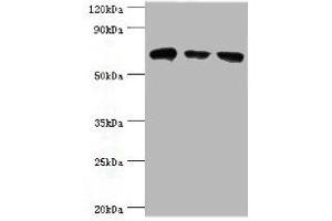 Western blot All lanes: HSPA2 antibody at 6 μg/mL Lane 1: A431 whole cell lysate Lane 2: Hela whole cell lysate Lane 3: Rat brain tissue Secondary Goat polyclonal to rabbit IgG at 1/10000 dilution Predicted band size: 70 kDa Observed band size: 70 kDa (HSPA2 抗体  (AA 400-639))
