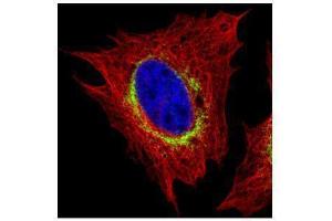 ICC/IF Image Confocal immunofluorescence analysis (Olympus FV10i) of paraformaldehyde-fixed HeLa, using Ribosome binding protein 1, antibody (Green) at 1:500 dilution. (RRBP1 抗体  (C-Term))