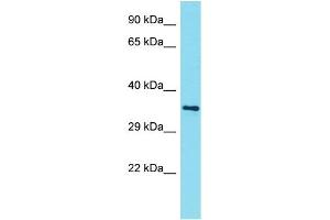 Host: Rabbit Target Name: AMMECR1L Sample Type: NCI-H226 Whole Cell lysates Antibody Dilution: 1. (AMMECR1-Like 抗体  (N-Term))