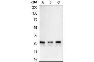 Western blot analysis of Carbonic Anhydrase 2 expression in Caco2 (A), K562 (B), Caki1 (C) whole cell lysates.