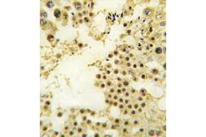 Image no. 1 for anti-Zinc Finger Protein 219 (ZNF219) (N-Term) antibody (ABIN357352) (ZNF219 抗体  (N-Term))