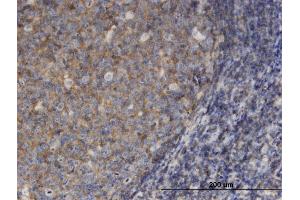 Immunoperoxidase of monoclonal antibody to MSN on formalin-fixed paraffin-embedded human tonsil. (Moesin 抗体  (AA 422-531))
