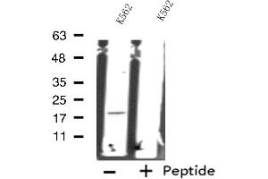 Western blot analysis of extracts from K562 cells, using RPS18 antibody. (RPS18 抗体)