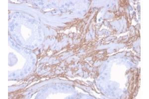 Formalin-fixed, paraffin-embedded human Prostate stained with Decorin Mouse Monoclonal Antibody (DCN/3523). (Decorin 抗体  (AA 212-336))