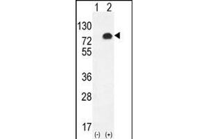 Western blot analysis of GPC6 (arrow) using rabbit polyclonal GPC6 Antibody (C-term) (ABIN655620 and ABIN2845100). (Glypican 6 抗体  (C-Term))