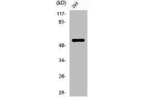 Western Blot analysis of 293 cells using Phospho-Synaptotagmin 1/2 (T202/199) Polyclonal Antibody (SYT1/SYT2 (pThr199), (pThr202) 抗体)