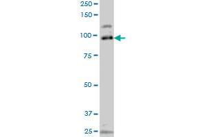 SRPK1 monoclonal antibody (M10A), clone 4G12 Western Blot analysis of SRPK1 expression in Jurkat . (SRPK1 抗体  (AA 371-470))