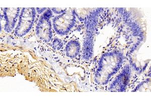 Detection of CALD in Rat Colon Tissue using Polyclonal Antibody to Caldesmon (CALD) (Caldesmon 抗体  (AA 434-531))