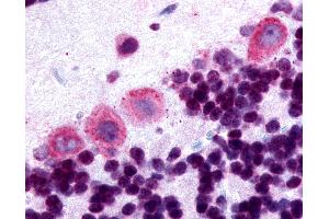 Anti-DRD5 / Dopamine Receptor D5 antibody IHC of human brain, cerebellum. (DRD5 抗体  (Cytoplasmic Domain))