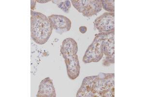 Immunohistochemistry (Paraffin-embedded Sections) (IHC (p)) image for anti-Colony Stimulating Factor 1 Receptor (CSF1R) (AA 940-971), (C-Term) antibody (ABIN391880)