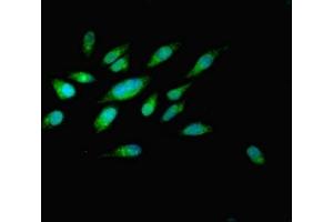 Immunofluorescent analysis of Hela cells using ABIN7162519 at dilution of 1:100 and Alexa Fluor 488-congugated AffiniPure Goat Anti-Rabbit IgG(H+L) (PILRB 抗体  (AA 20-191))
