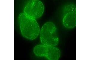 Immunofluorescent staining of HeLa cells with Nup153 monoclonal antibody, clone R4C8 . (NUP153 抗体)