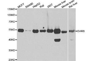 Western blot analysis of extracts of various cell lines, using DARS antibody. (DARS 抗体)