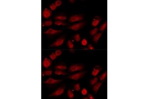 Immunofluorescence analysis of U20S cell using TP53BP1 antibody. (TP53BP1 抗体)