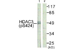 Immunohistochemistry analysis of paraffin-embedded human skin tissue using HDAC3 (Phospho-Ser424) antibody. (HDAC3 抗体  (pSer424))