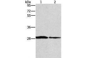 Western Blot analysis of Human chromaffin cell tumor tissue and lovo cell using SPR Polyclonal Antibody at dilution of 1:1500 (SPR 抗体)