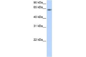 WB Suggested Anti-TRIM9 Antibody Titration:  0. (TRIM9 抗体  (C-Term))