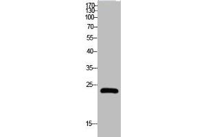 Western Blot analysis of HELA cells using Claudin-5 Polyclonal Antibody (Claudin 5 抗体  (C-Term))
