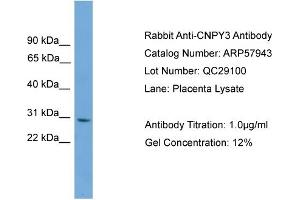 WB Suggested Anti-CNPY3  Antibody Titration: 0. (TNRC5 抗体  (Middle Region))